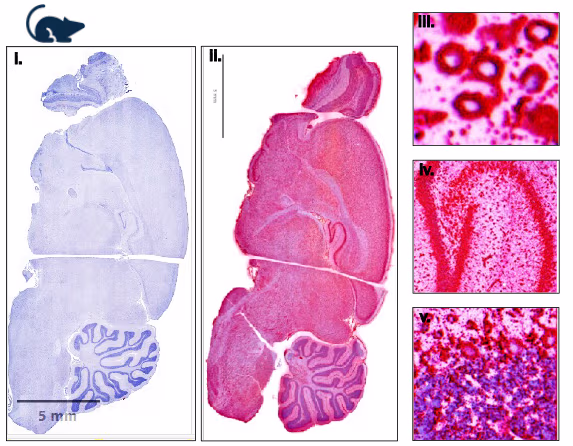 A group of 5 images of segments of a rat brain showing distribution of PYC-002 in brains from Sprague-Dawley rats (Rattus norvegicus) treated with i. vehicle control or ii-v. low dose PYC-002 for 14 days. Samples stained with in situ hybridisation probe targeting PYC-002 ASO (red) and counter-stained with hematoxylin. i. and ii. Whole Brain, iii. Cortex, iv. Hippocampus, v. Cerebellum.